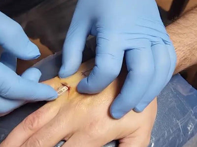 Tesla Owners "transformation" of The Body: Car Keys Implanted in The Arm